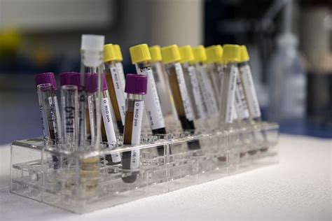 elisa test tube color|elisa's positive blood test.